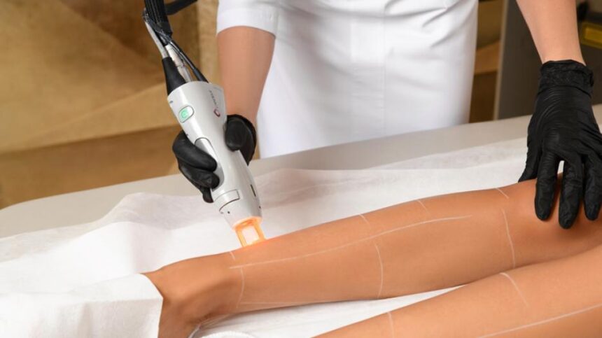 plaukusalinimaslazeriup