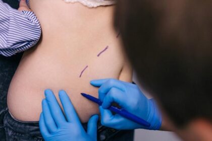 71pilvoplastikapogimdymoatkurkitekunoformairpasitikejimasavimi