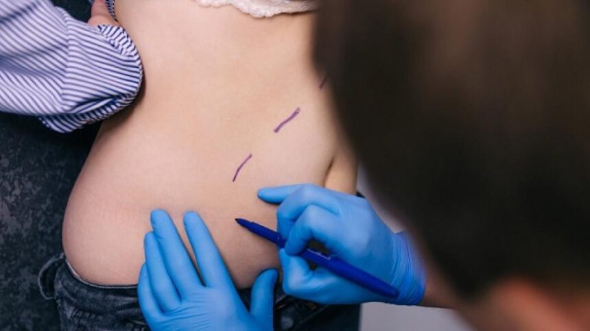 71pilvoplastikapogimdymoatkurkitekunoformairpasitikejimasavimi